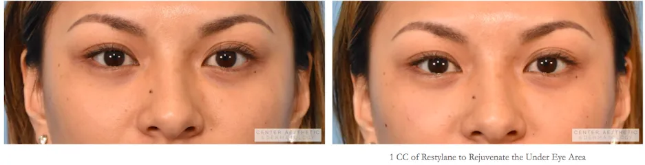 Center Aesthetic & Dermatology