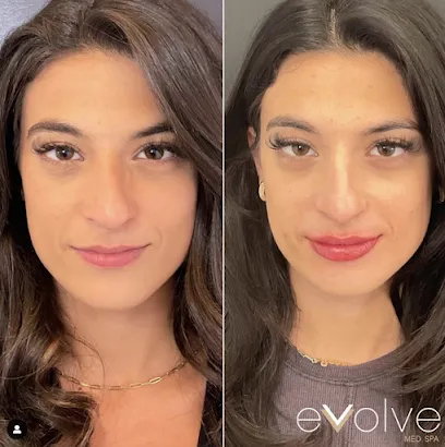 Evolve Med Spa