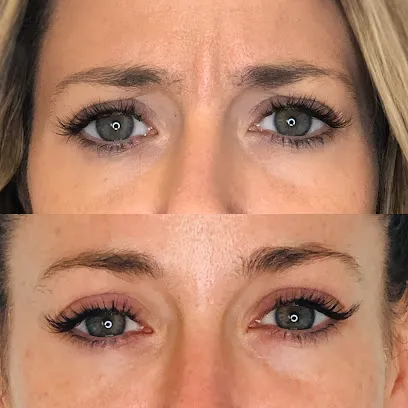 Glowtox - Botox, Sofwave, Microneedling, Sculptra and Filler Specialists