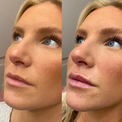 Plump Cosmetics & Injectables