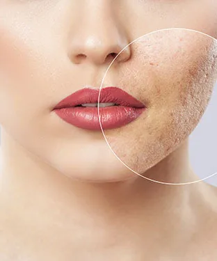 Renu Medical Spa